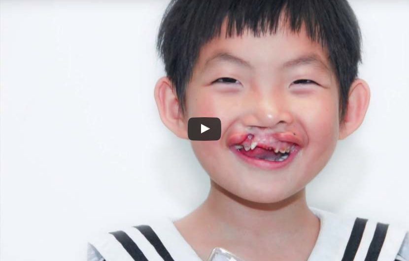 Amazing Transformations