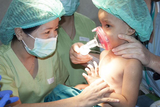 Everything you need to know about cleft lip and palate surgery