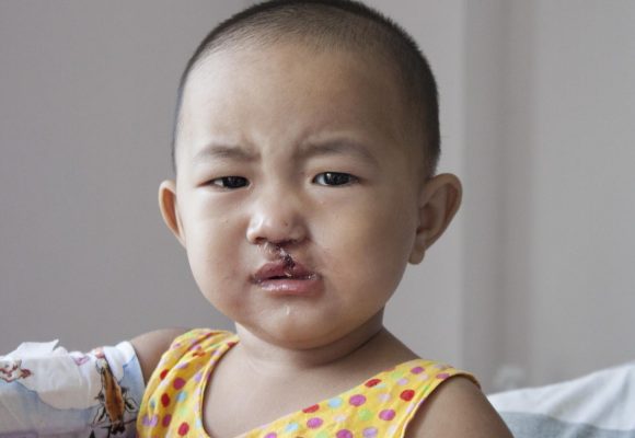 Day Five – Global Smile Day!