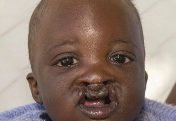 You still have time to help!