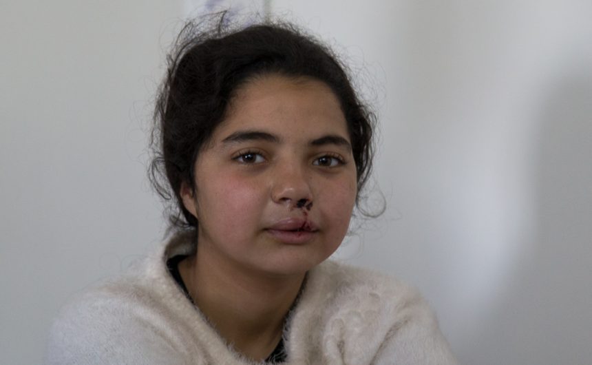 058AMK18_12_girl_after Morocco – Transforming Lives of Children