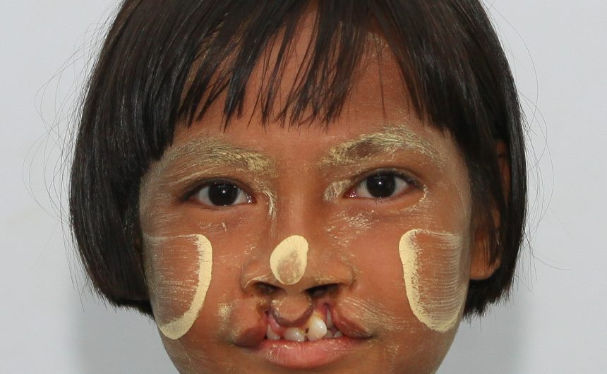 060-A-MK17-001 Transformation Tuesday