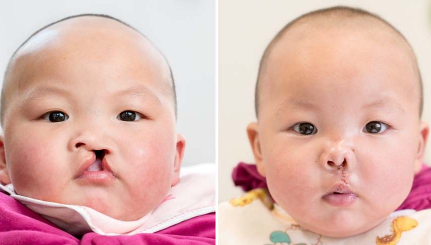 huang Tuesday Transformations in Zhaotong China