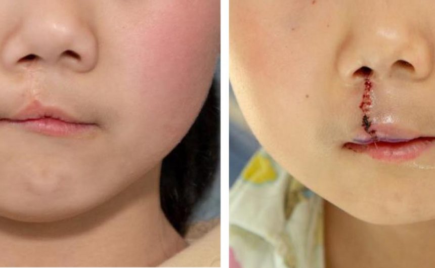 surgeryward2 On the Surgery Ward β Chuzhou, China