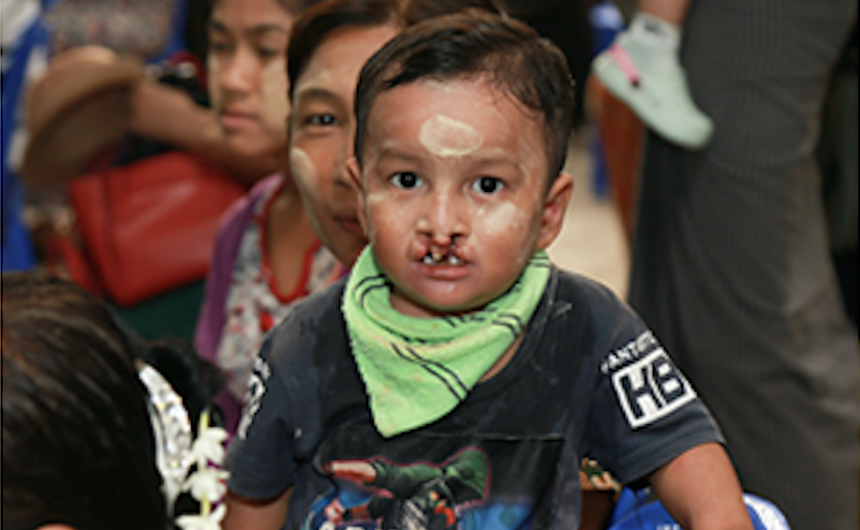 Day 1-2 Opening clinic – Day 1 + 2