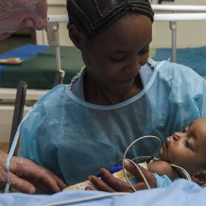 Hawassa Ethiopia – Fourth Surgery Day