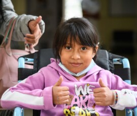 Thumbs up after cleft surgery